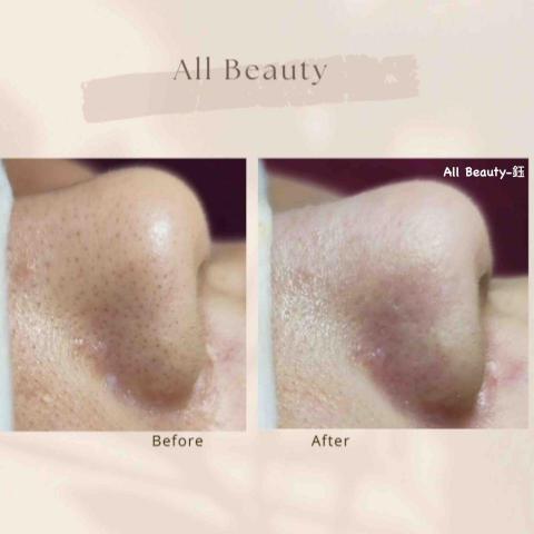 All Beauty｜中壢複合式美學空間・皮膚管理・熱蠟除毛 - 肌膚管理
