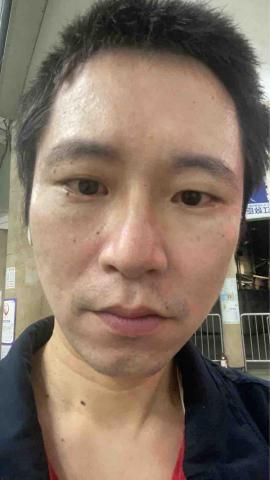 蔡子喬 - 養膚後