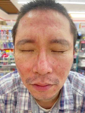 蔡子喬 - 養膚前