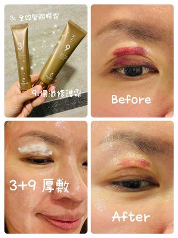 經筋有位| 經絡調理 x 專業鬆筋按摩師 - 產品介紹-輕鬆美麗去瘀保濕