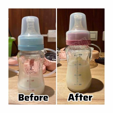 煦願&middot;台中到府乳腺疏通 - 產後第五天，媽咪還在月中就做了第一次乳腺疏通。疏通完從原本奶量30ml衝到將近90ml！！！