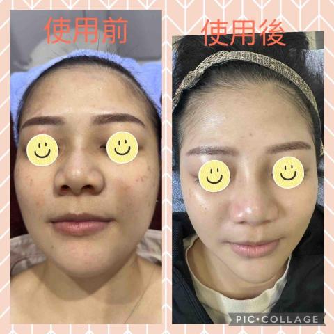 艾薇spa - 改善斑點/暗沉