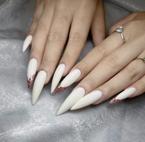 陳洛彤 - 簡約金屬法式款（延長矯正）