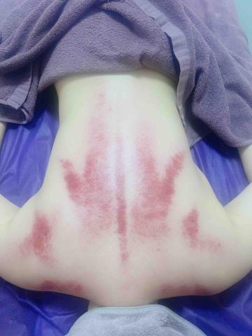 沐•芳療美學 - 按摩刮痧