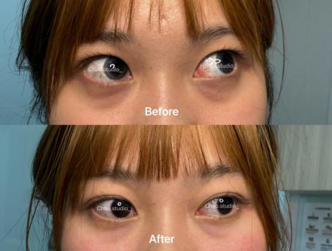 Chao Studio - 黑眼圈遮瑕