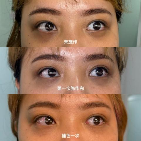 Chao Studio - 黑眼圈遮瑕