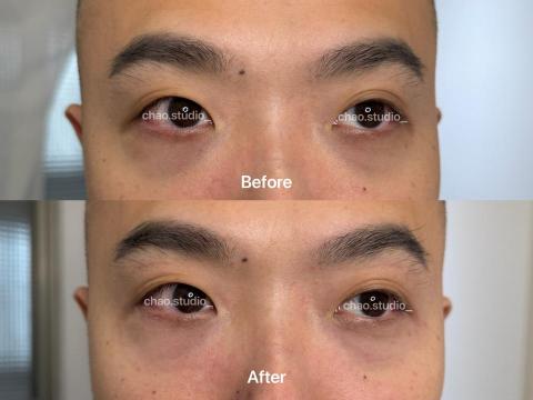 Chao Studio - 黑眼圈遮瑕