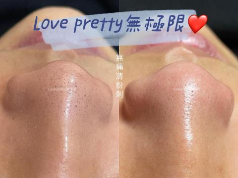 Love pretty無極限 - 