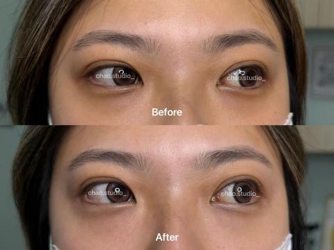 Chao Studio - 黑眼圈遮瑕