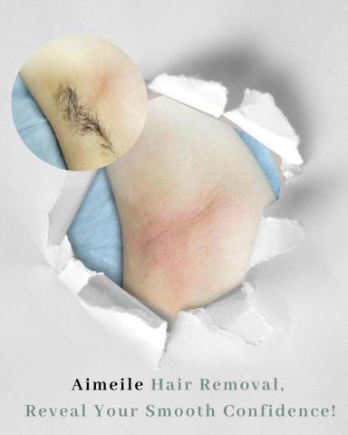 艾媄樂 - 腋下除毛 / 看更多作品請連結linkby OR 加入賴官方看更多