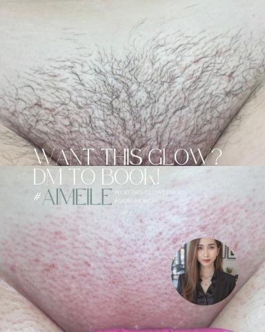 艾媄樂 - 私密處除毛 / 看更多作品請連結linkby OR 加入賴官方看更多