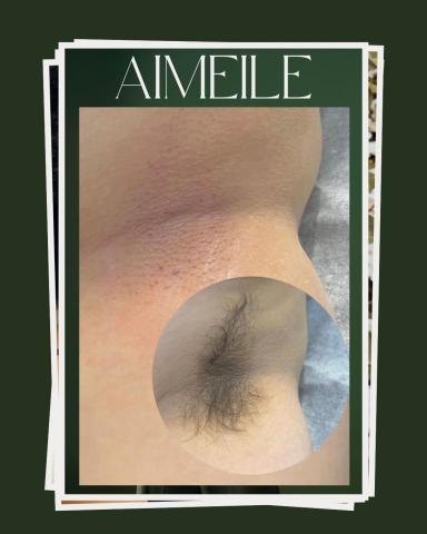 艾媄樂 - 腋下除毛