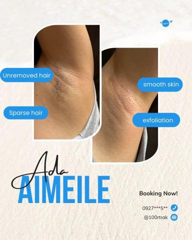 艾媄樂 - 腋下除毛