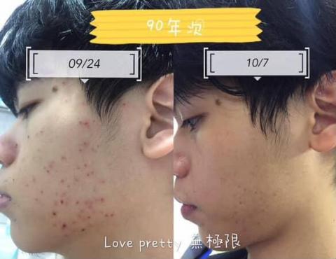 Love pretty無極限 - 