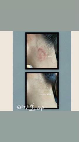 Love pretty無極限 - 