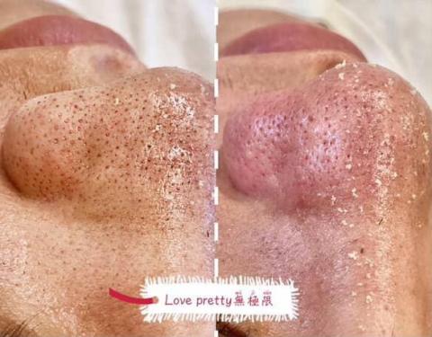 Love pretty無極限 - 