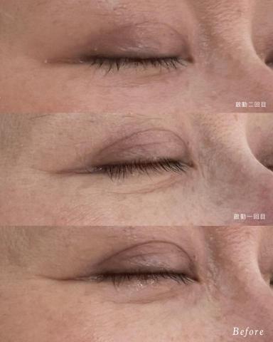 Nico chen - 堅持使用全進口商品進行護膚療程