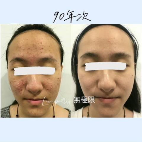 Love pretty無極限 - 