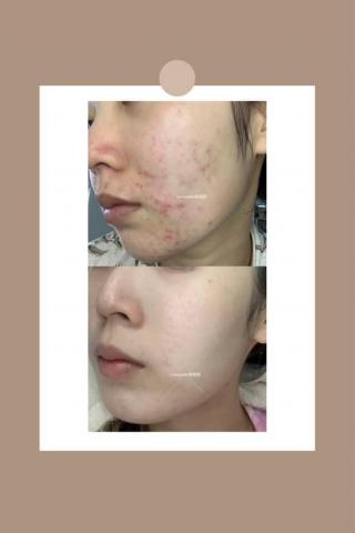 Love pretty無極限 - 