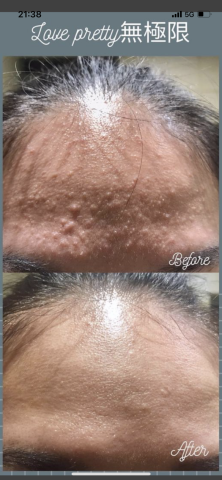 Love pretty無極限 - 