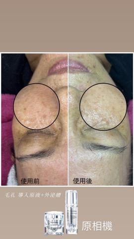 茉莉美學 - 皮膚管理：外泌體課程