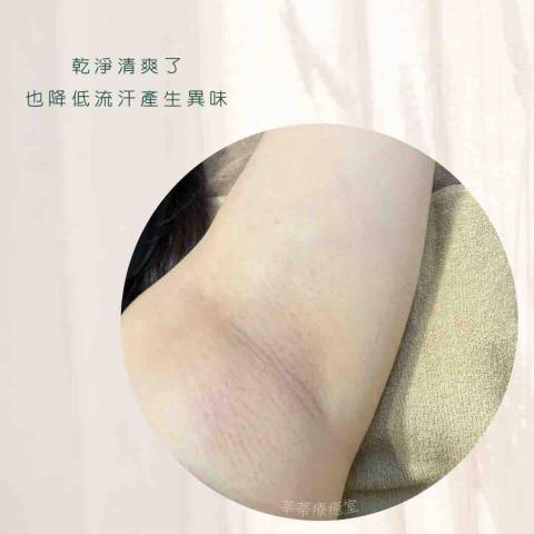 莘蒂療癒室 - 腋下熱蠟除毛，毛毛掰掰，腋下容易流汗來找我除毛，清爽許多，終於不會有腋毛黏在皮膚上