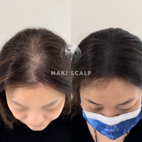 蒔物所 - Instagram：makimono.scalp
Line：@933opjxh