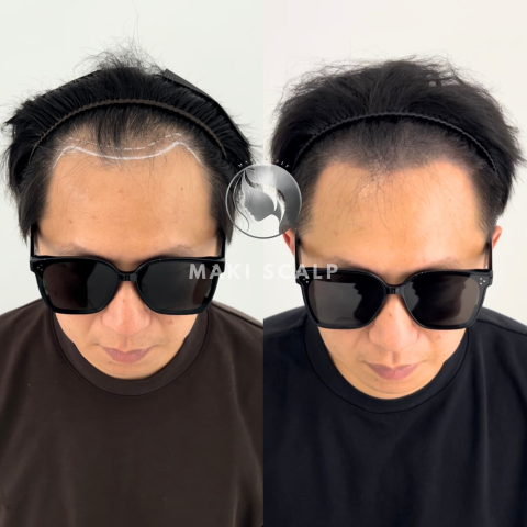 蒔物所 - Instagram：makimono.scalp
Line：@933opjxh