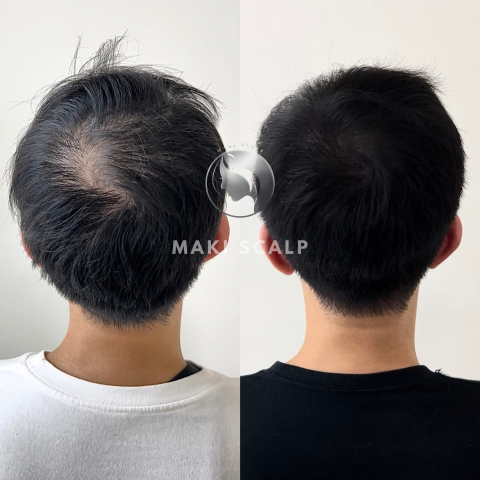 蒔物所 - Instagram：makimono.scalp
Line：@933opjxh