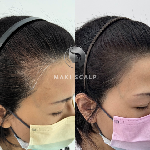 蒔物所 - Instagram：makimono.scalp
Line：@933opjxh