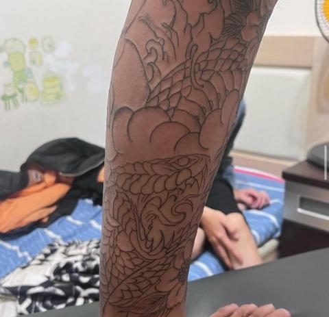 阿傑 - 小腿割線