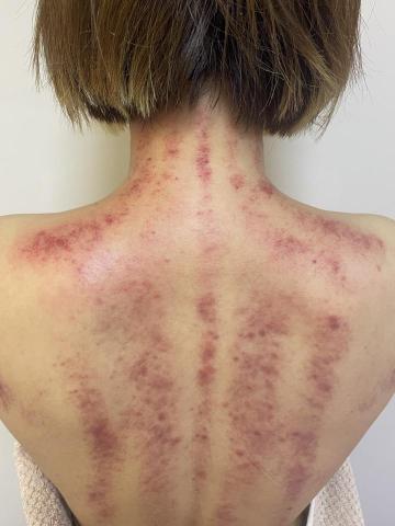 按摩溫罐芳療/男女仕私密護理 - 艾草溫罐從頭到腳