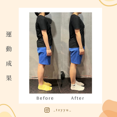 Vivian - 21 歲妹妹因精緻飲食，無運動習慣，體重開始直線上升，無精打采，怎麼睡都睡不飽。

開始重訓增肌減脂，一個月 8 堂課，搭配熱量控管，兩個月後 體重減2公斤，體態改善：
圓肩駝背、骨盆前移、小腹凸出、腰酸 --> 強化後側鏈（臀腿背），站立重心向後調整，整個人像長高一樣，肌肉支撐向上撐起，胸背挺直！