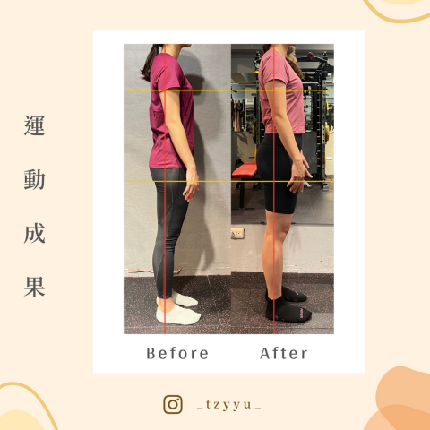Vivian - 久坐上班族，有骨盆前移＋後傾問題、圓肩駝背，一週2次運動，4 個月後，臀部維度明顯增長，肌肉量上升，胸線上提，肩線後收。