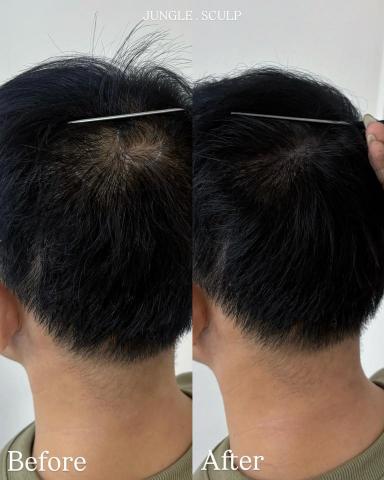 叢生ᴶᵁᴺᴳᴸᴱ｜SMP仿真紋髮｜野生感飄霧眉 - 男士後腦勺空洞填補