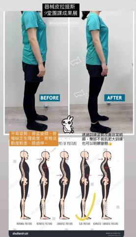 物理治療師/健身教練/器械式皮拉提斯教練-林佩君 - 骨盆後傾案例 物理治療師/健身教練/器械式皮拉提斯教練-林佩君 - 骨盆後傾案例