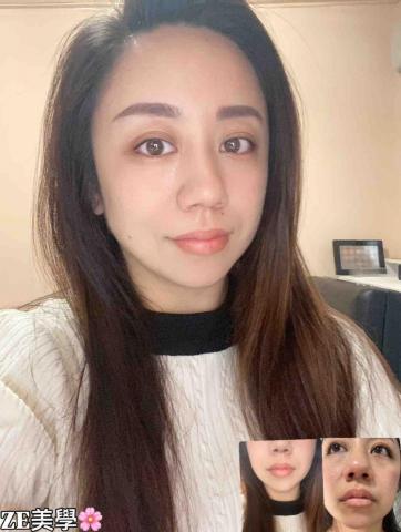 ZE美學 - ZE美學?
給你帶來完美的自信
讓你素顏也很美?
