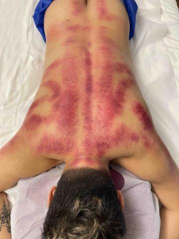 15年經驗 到府按摩師 - 