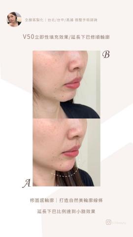 游珩君 - IG醫美顧問-限時動態、貼文