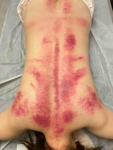 15年經驗 到府按摩師 - 