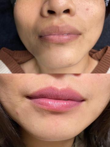 宜蘭羅東zoe佐依韓式半永久 - 