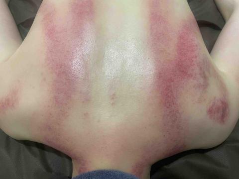 AH美容美體SPA美學館 - 排濕課程