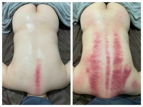 AH美容美體SPA美學館 - 深度排濕課程