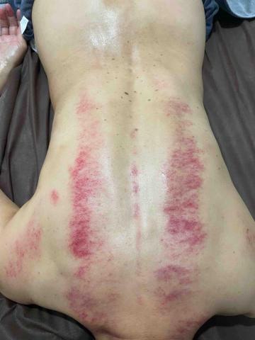 AH美容美體SPA美學館 - 深度排濕課程