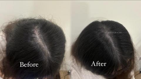 曦妍美學 - 女生分線填補