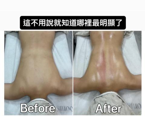 Moonis沐尼斯美療 - 放鬆調整高低肩