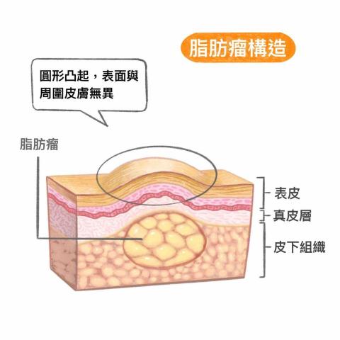 王思驊 - 社群合作/疾病科普插畫