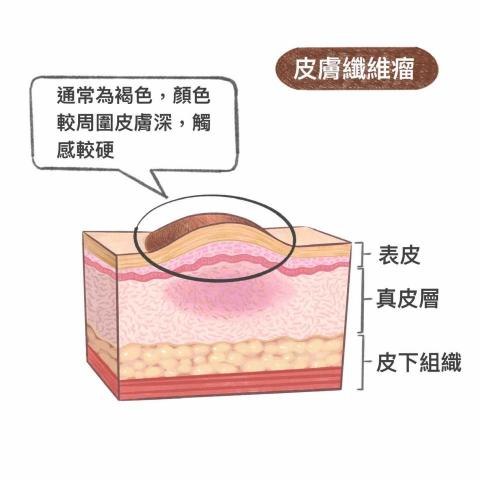 王思驊 - 社群合作/疾病科普插畫