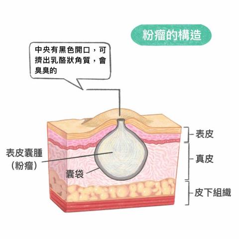 王思驊 - 社群合作/疾病科普插畫