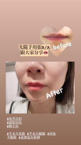 Clinicforheart - 改善暗沉唇色/半永久霧唇